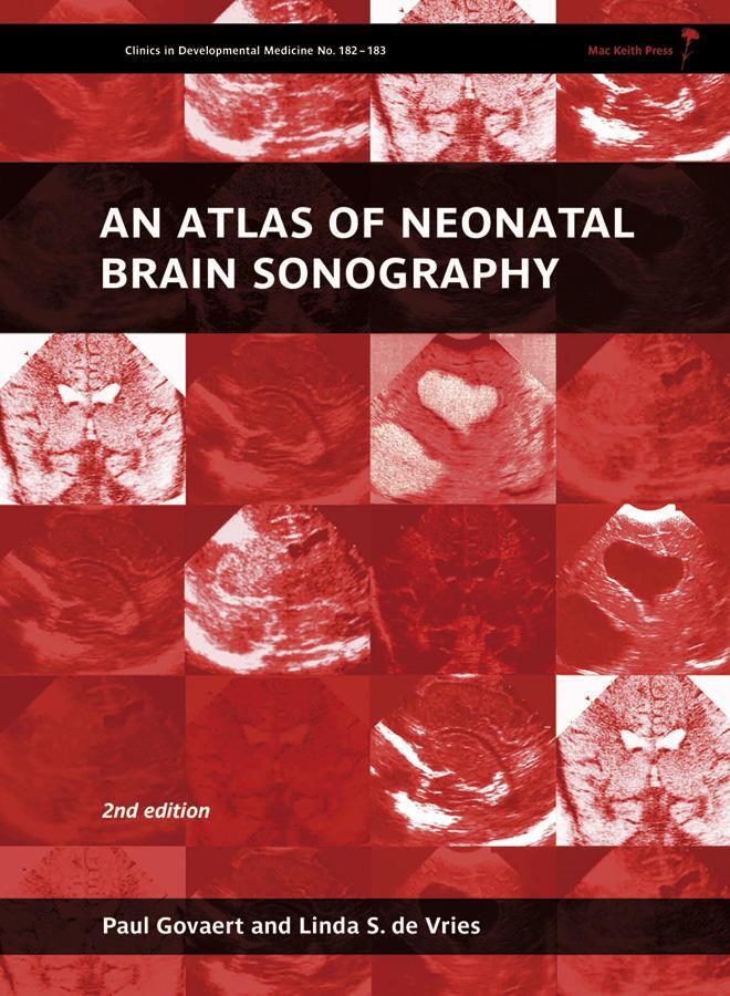 Cover: 9781898683568 | An Atlas of Neonatal Brain Sonography | Paul Govaert (u. a.) | Buch
