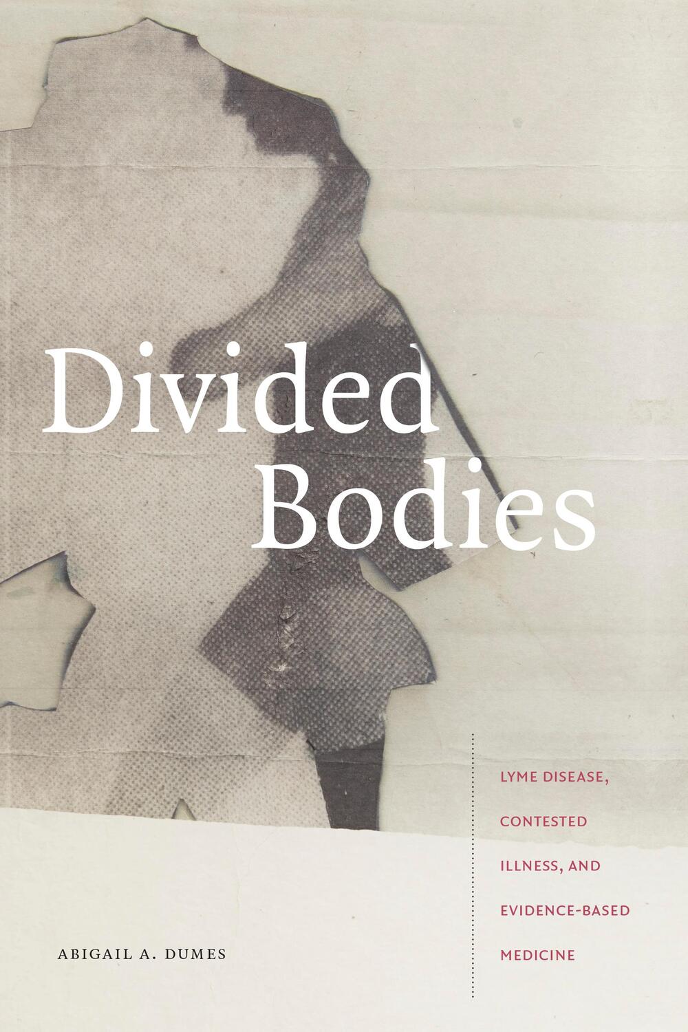 Cover: 9781478006664 | Divided Bodies | Abigail A. Dumes | Taschenbuch | Englisch | 2020