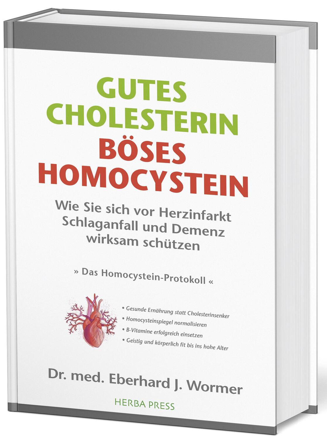 Cover: 9783946245063 | Gutes Cholesterin - Böses Homocystein | Eberhard J. Wormer | Buch