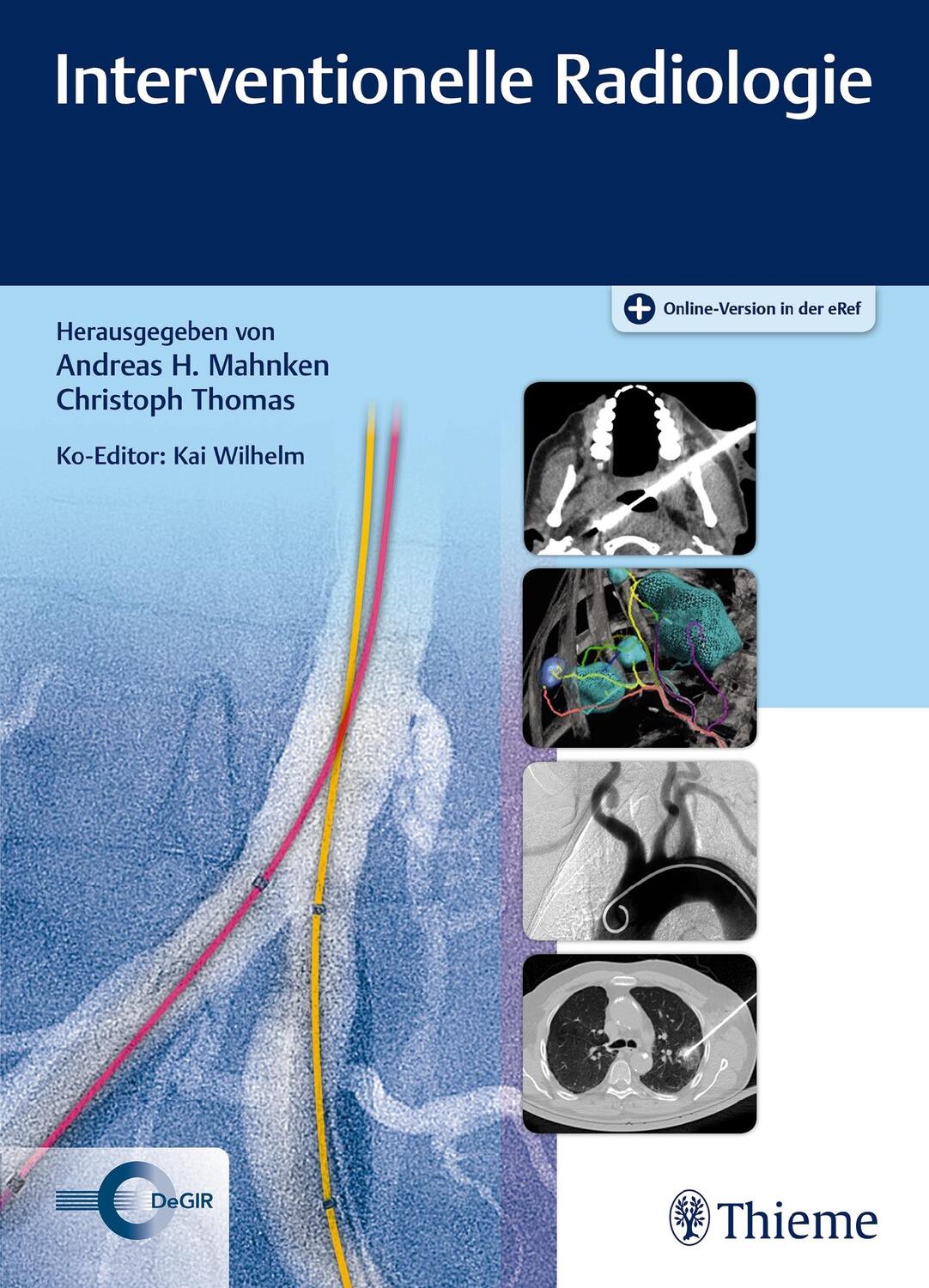 Cover: 9783132214514 | Interventionelle Radiologie | Andreas H. Mahnken (u. a.) | Bundle