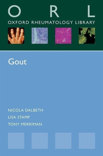 Cover: 9780198748311 | Gout | Nicola Dalbeth (u. a.) | Taschenbuch | Kartoniert / Broschiert