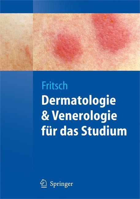 Cover: 9783540793021 | Dermatologie & Venerologie für das Studium | Peter Fritsch | Buch