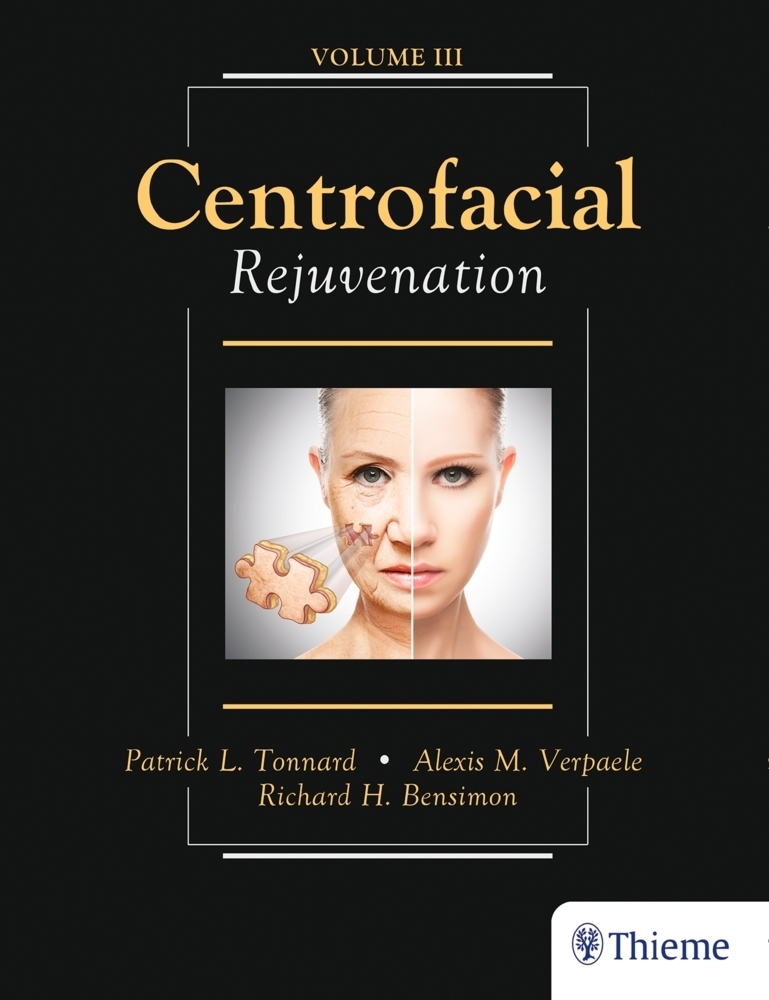 Cover: 9781626236868 | Centrofacial Rejuvenation | With online access | Tonnard (u. a.)