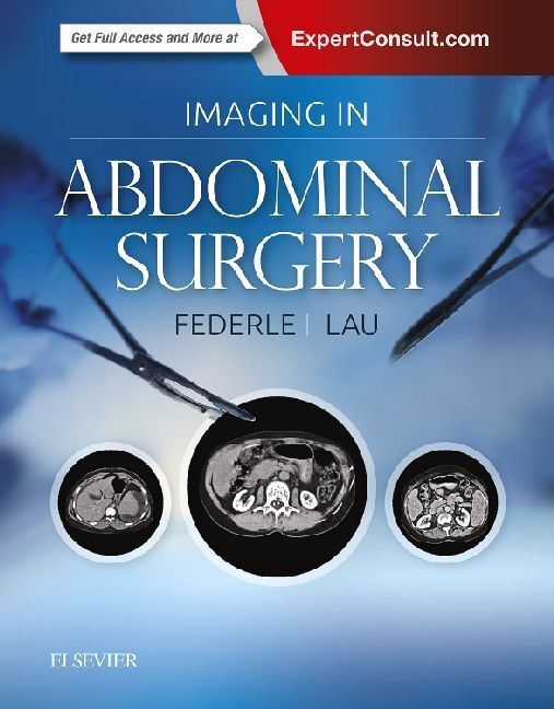 Cover: 9780323611350 | Imaging in Abdominal Surgery | Michael P Federle (u. a.) | Buch | 2018