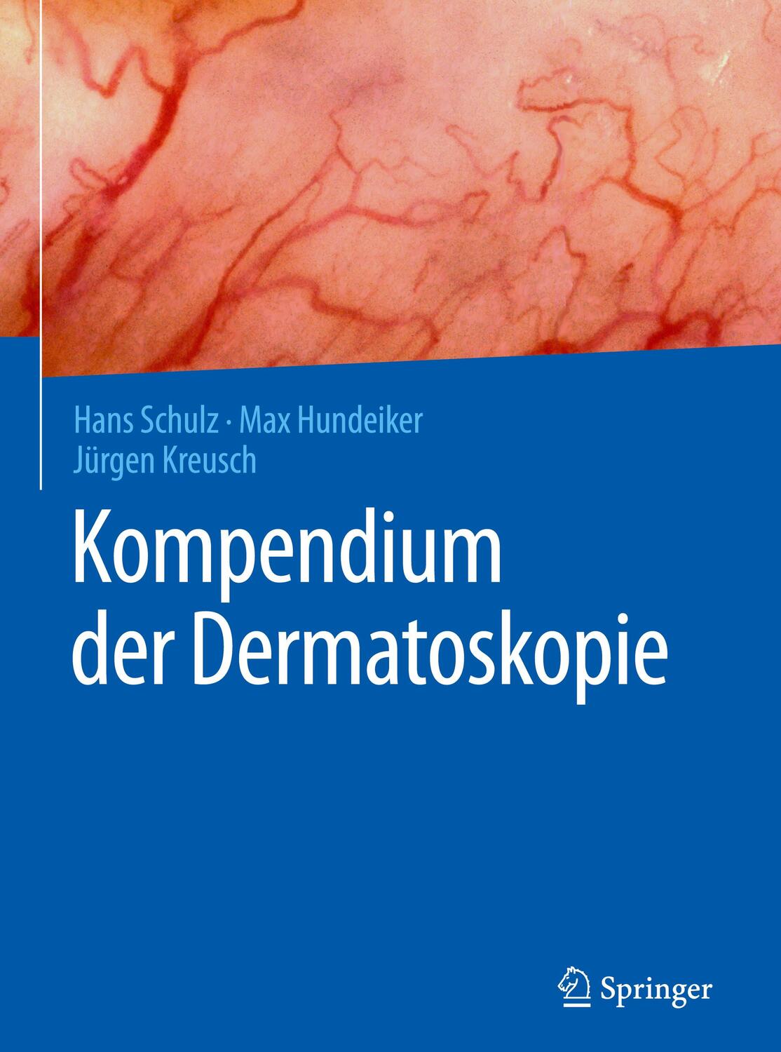 Cover: 9783662494905 | Kompendium der Dermatoskopie | Schulz | Buch | XI | Deutsch | 2016