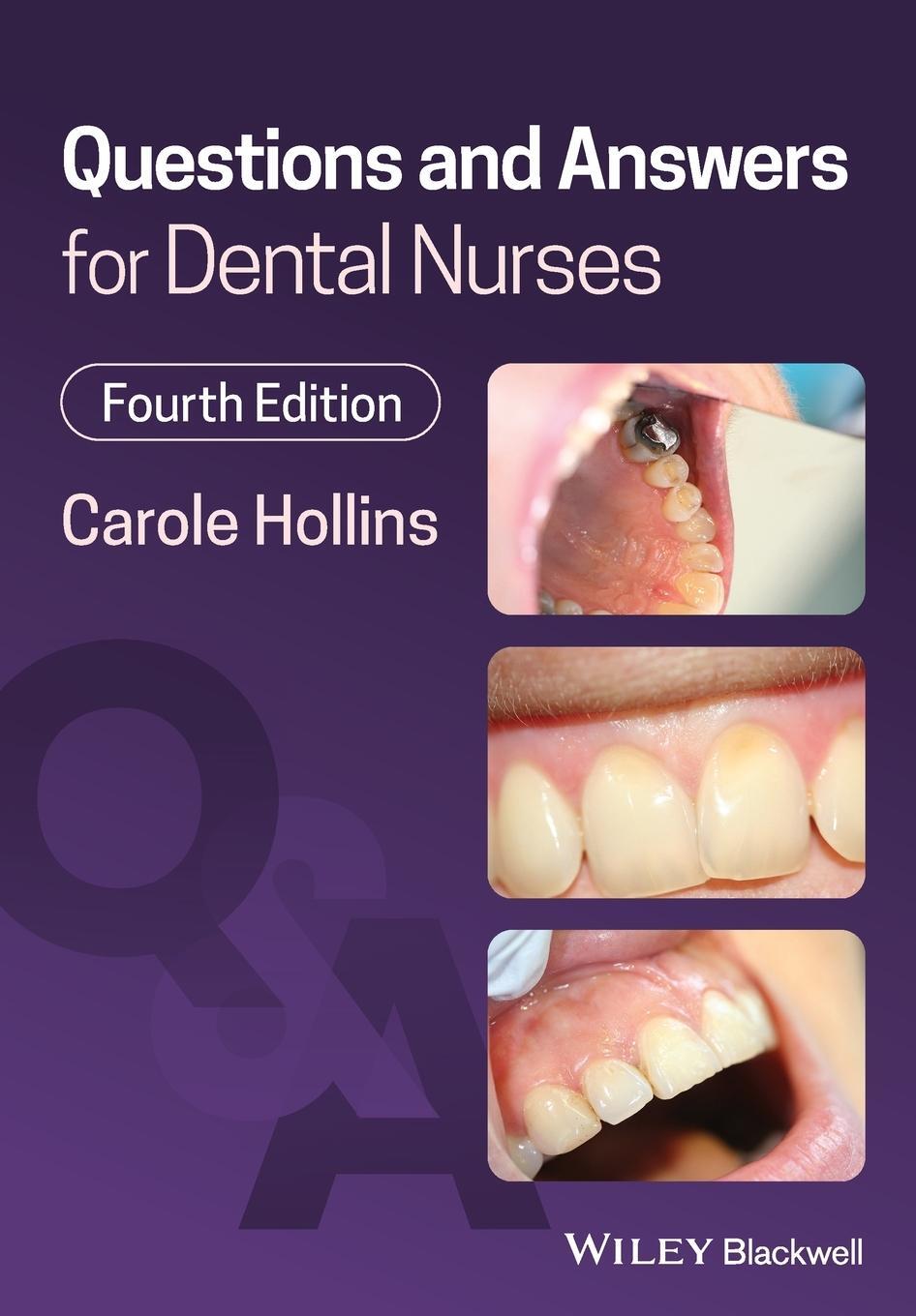 Cover: 9781119785200 | Questions and Answers for Dental Nurses | Carole Hollins | Taschenbuch
