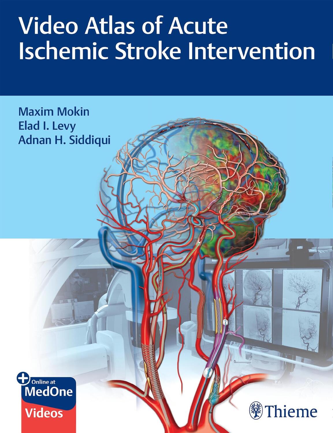 Cover: 9781684202492 | Video Atlas of Acute Ischemic Stroke Intervention | Mokin (u. a.)
