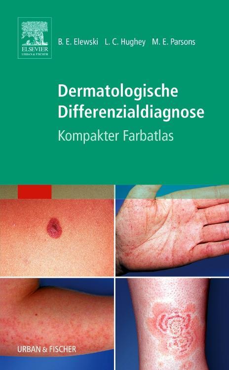 Cover: 9783437243400 | Dermatologische Differenzialdiagnose | Kompakter Farbatlas | Buch
