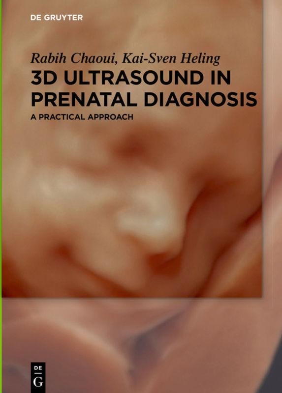Cover: 9783110496512 | 3D Ultrasound in Prenatal Diagnosis | A practical approach | Buch