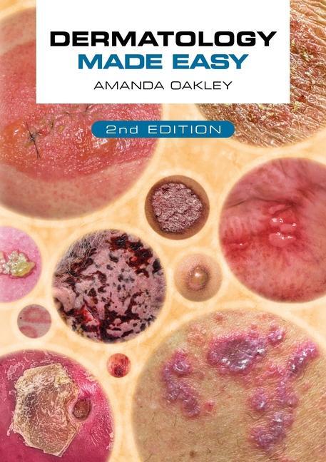 Cover: 9781914961168 | Dermatology Made Easy, second edition | Amanda Oakley | Taschenbuch