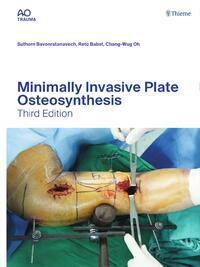 Cover: 9783132454255 | Minimally Invasive Plate Osteosynthesis | Bavonratanavech (u. a.)