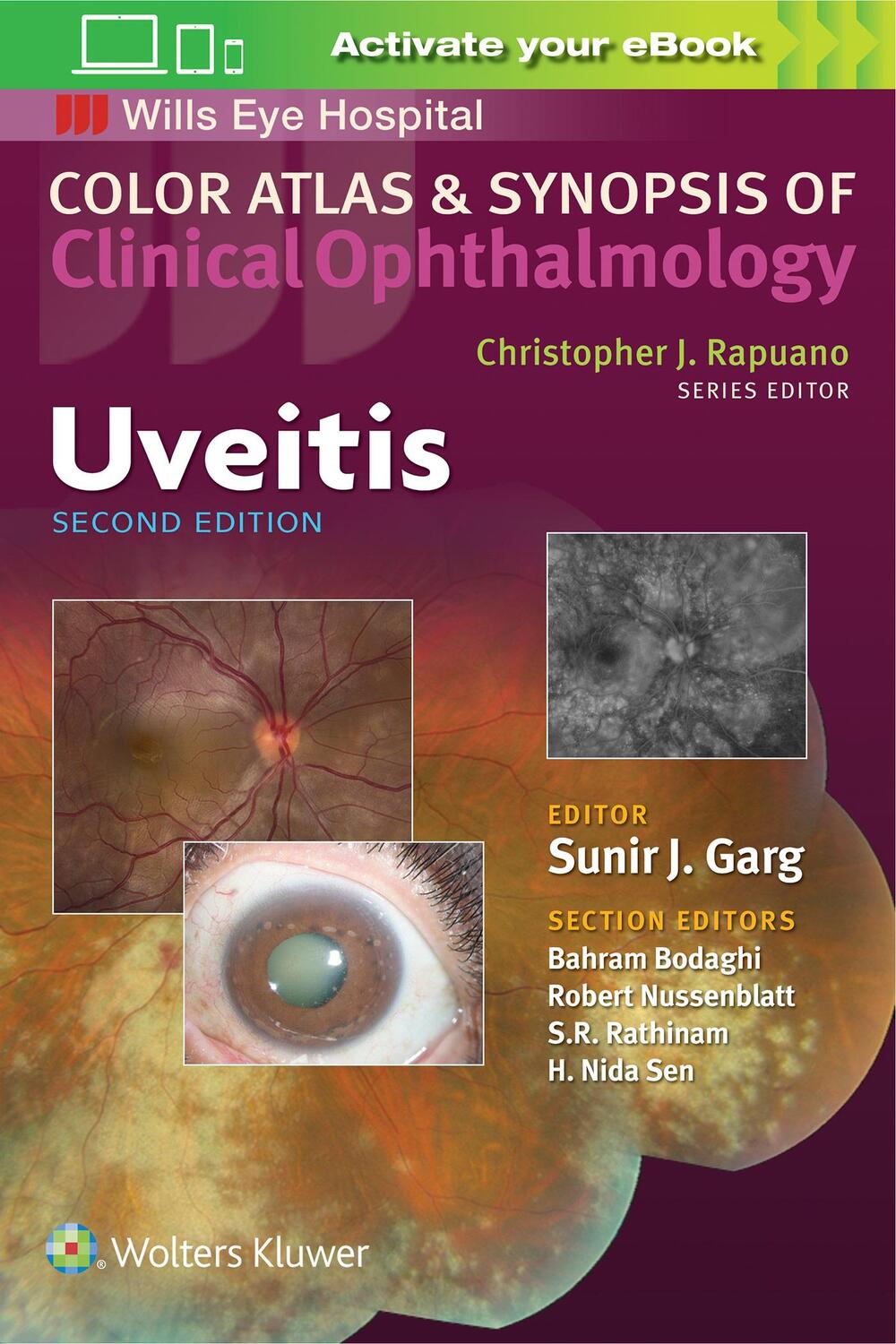 Cover: 9781496363008 | Uveitis (Color Atlas and Synopsis of Clinical Ophthalmology) | Garg