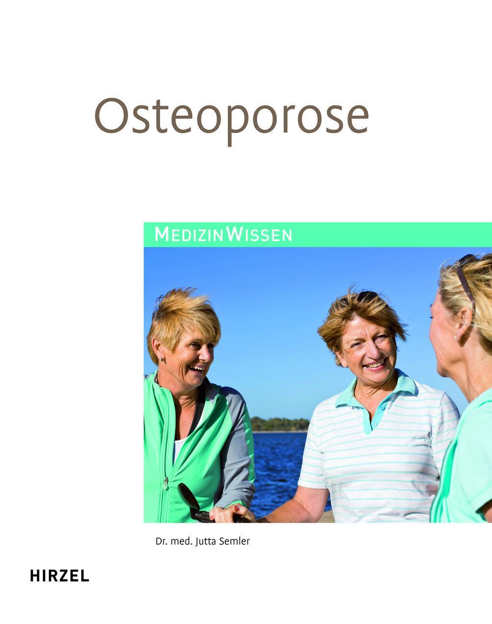 Cover: 9783777621265 | Osteoporose | Jutta Semler | Taschenbuch | 196 S. | Deutsch | 2011