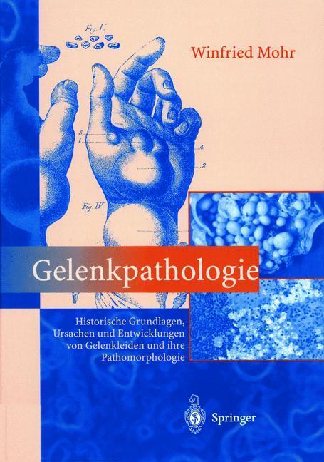 Cover: 9783642630156 | Gelenkpathologie | Winfried Mohr | Taschenbuch | Paperback | xxi