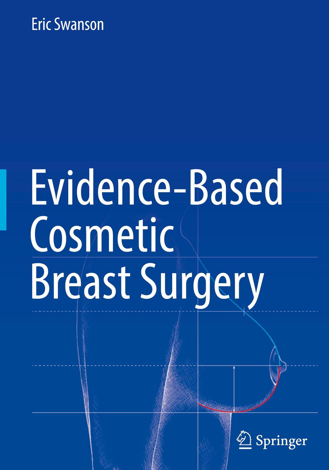 Cover: 9783319539577 | Evidence-Based Cosmetic Breast Surgery | Eric Swanson | Buch | XIV