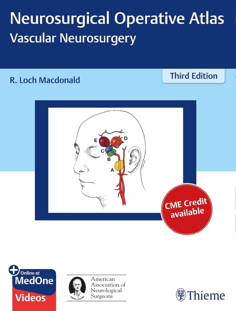 Cover: 9781626231108 | Neurosurgical Operative Atlas: Vascular Neurosurgery | Macdonald