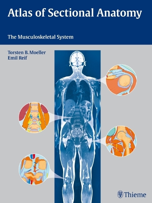 Cover: 9783131465412 | Atlas of Sectional Anatomy | The Musculoskeletal System | Buch | 2009