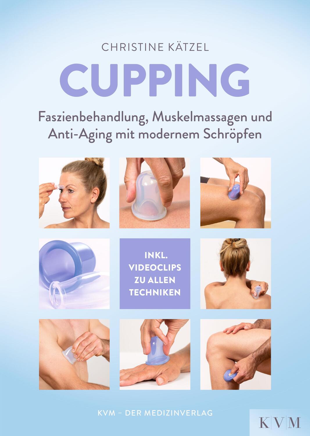 Cover: 9783868674859 | Cupping | Christine Kätzel | Taschenbuch | Deutsch | 2019