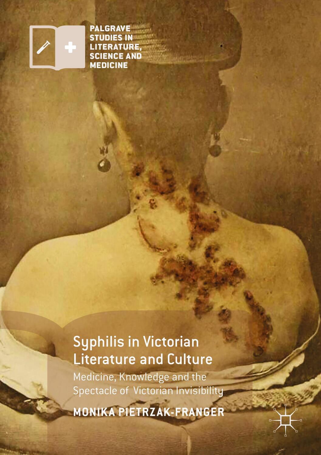 Cover: 9783319495347 | Syphilis in Victorian Literature and Culture | Monika Pietrzak-Franger