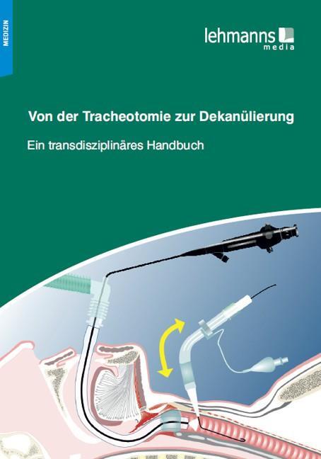 Cover: 9783865415127 | Von der Tracheotomie zur Dekanülierung | Taschenbuch | Deutsch | 2013