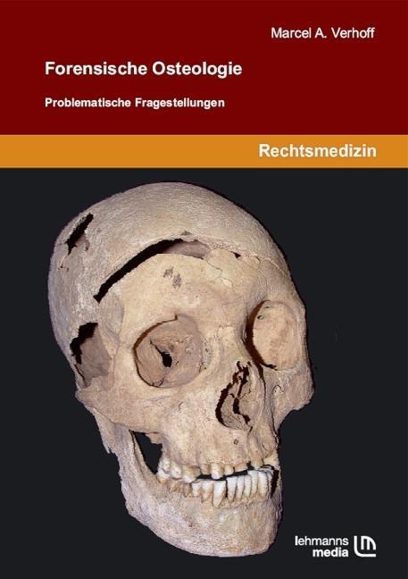 Cover: 9783865412942 | Forensische Osteologie | Problematische Fragestellungen | Verhoff