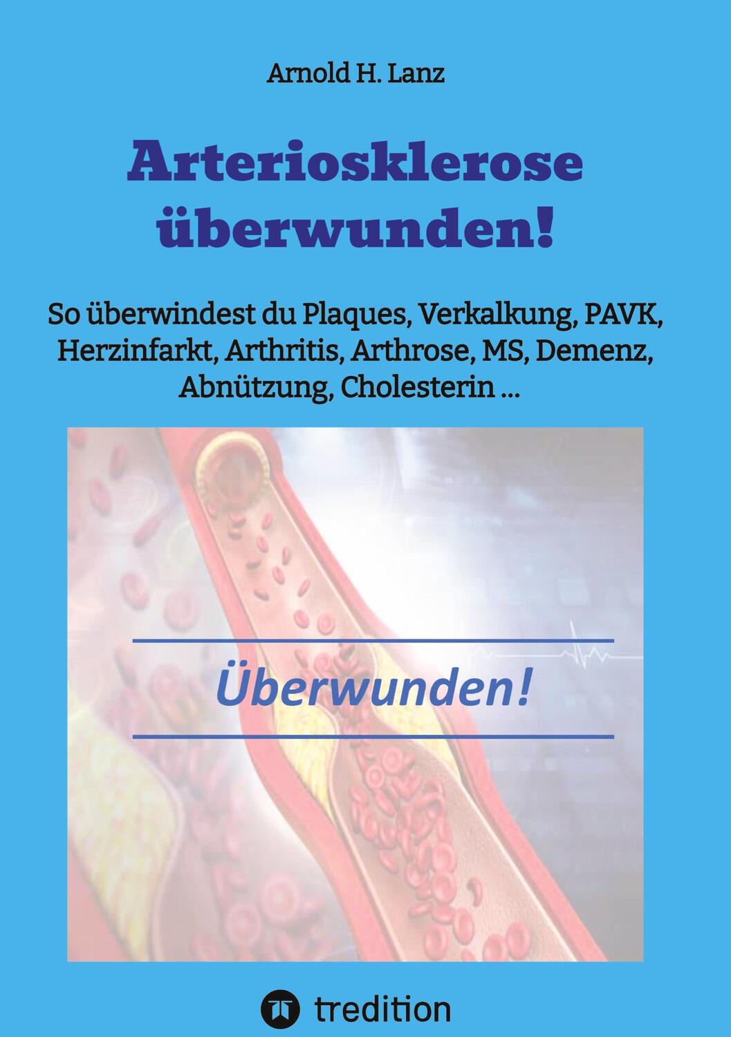 Cover: 9783384006486 | Arteriosklerose überwunden! | Arnold H. Lanz | Buch | 104 S. | Deutsch