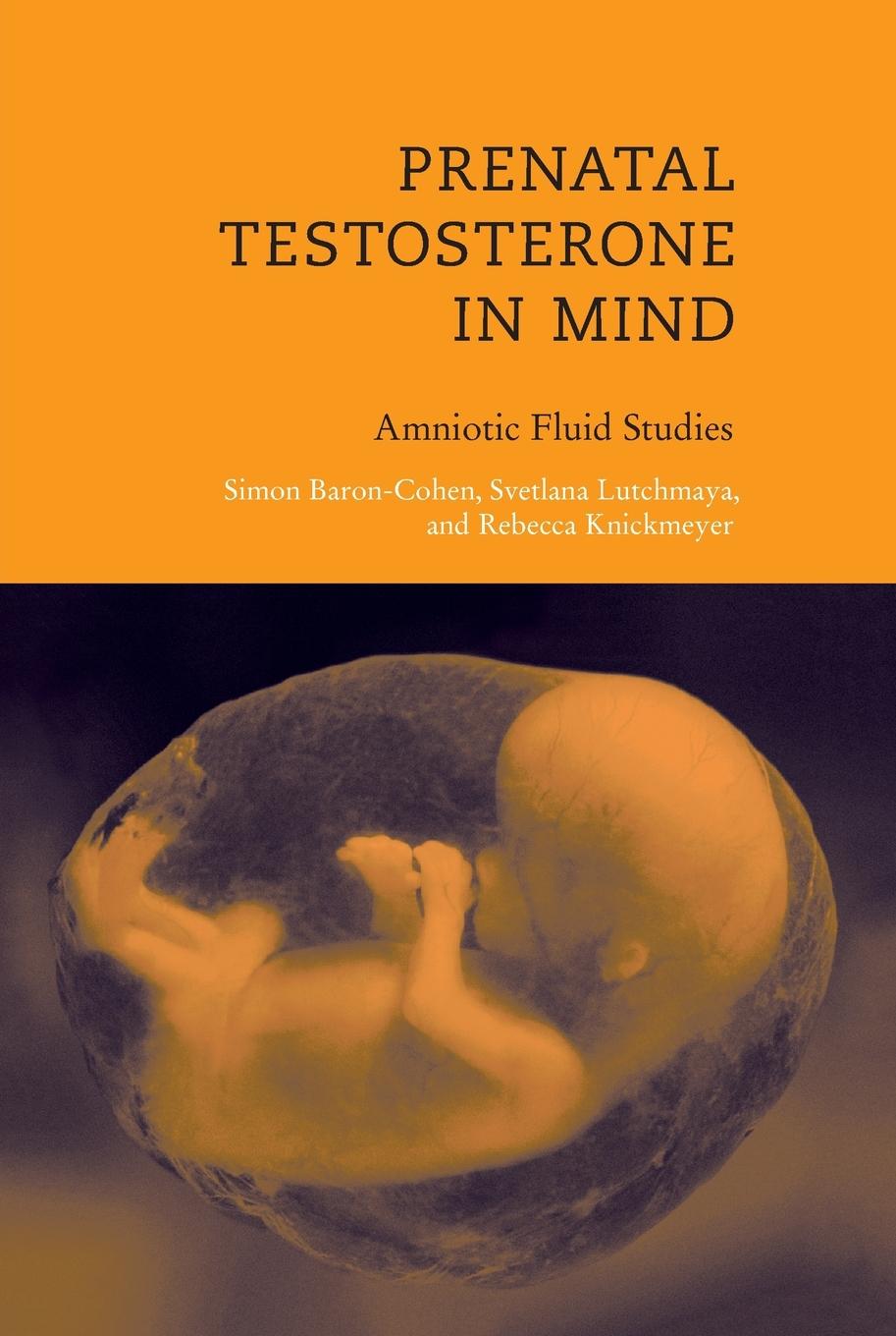 Cover: 9780262524568 | Prenatal Testosterone in Mind | Amniotic Fluid Studies | Taschenbuch