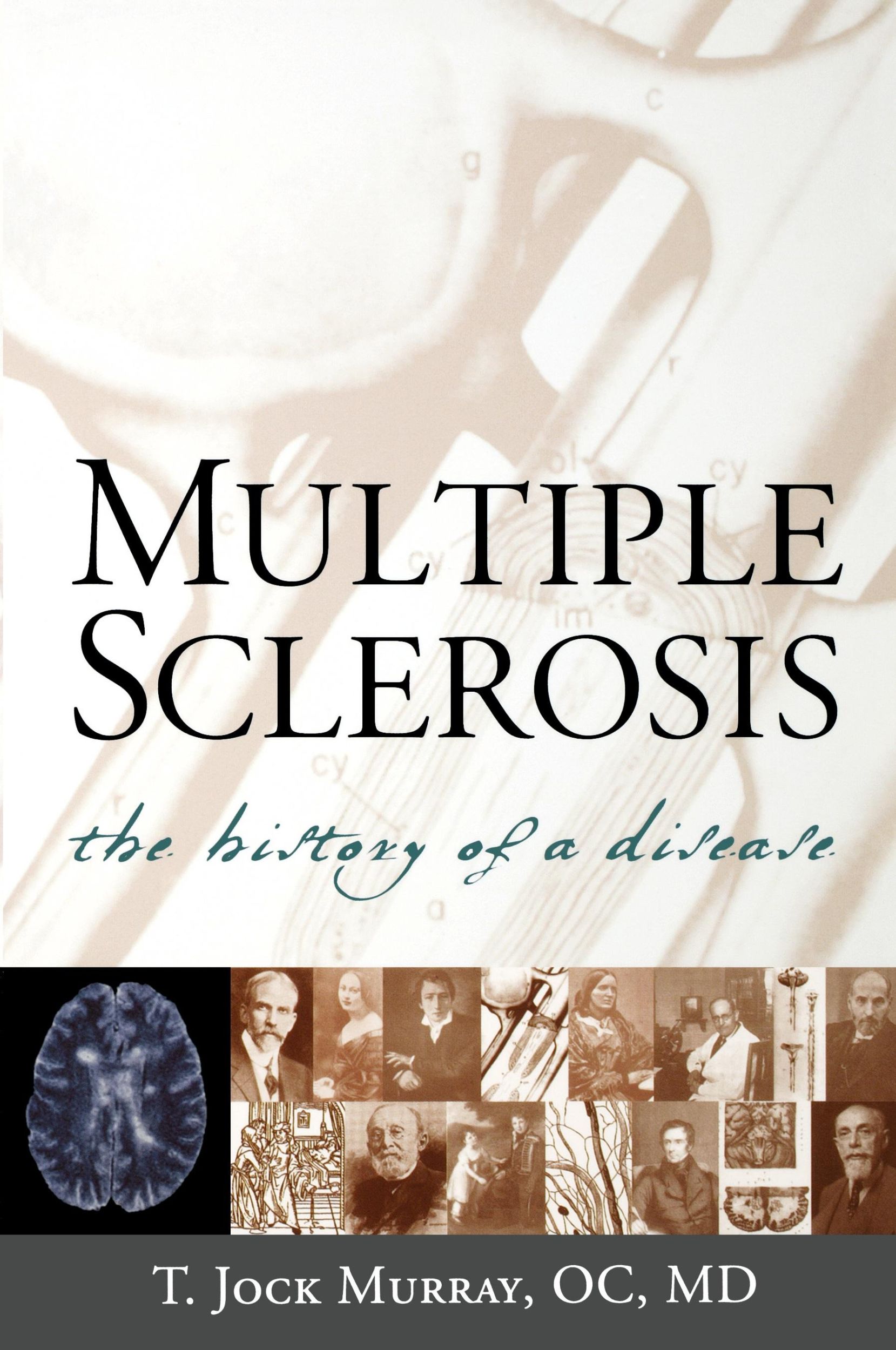 Cover: 9781888799804 | Multiple Sclerosis | The History of a Disease | T. Jock MD Murray