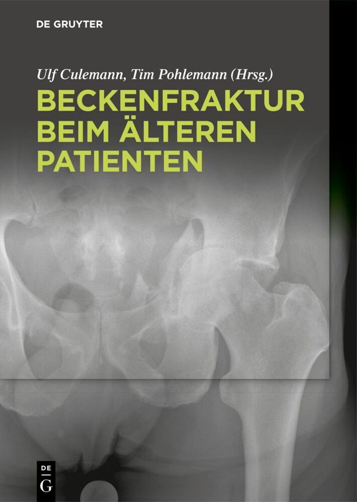 Cover: 9783110426489 | Beckenfraktur beim älteren Patienten | Ulf Culemann (u. a.) | Buch