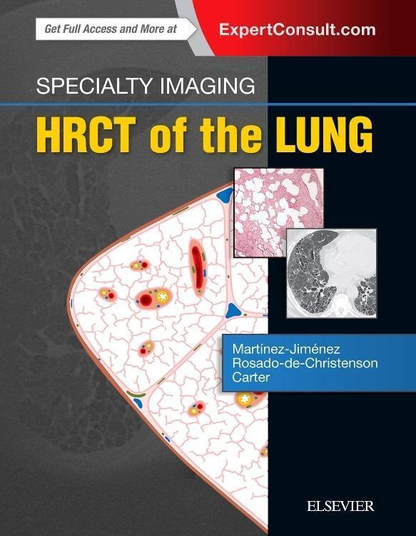 Cover: 9780323524773 | Specialty Imaging: Hrct of the Lung | Martínez-Jiménez (u. a.) | Buch