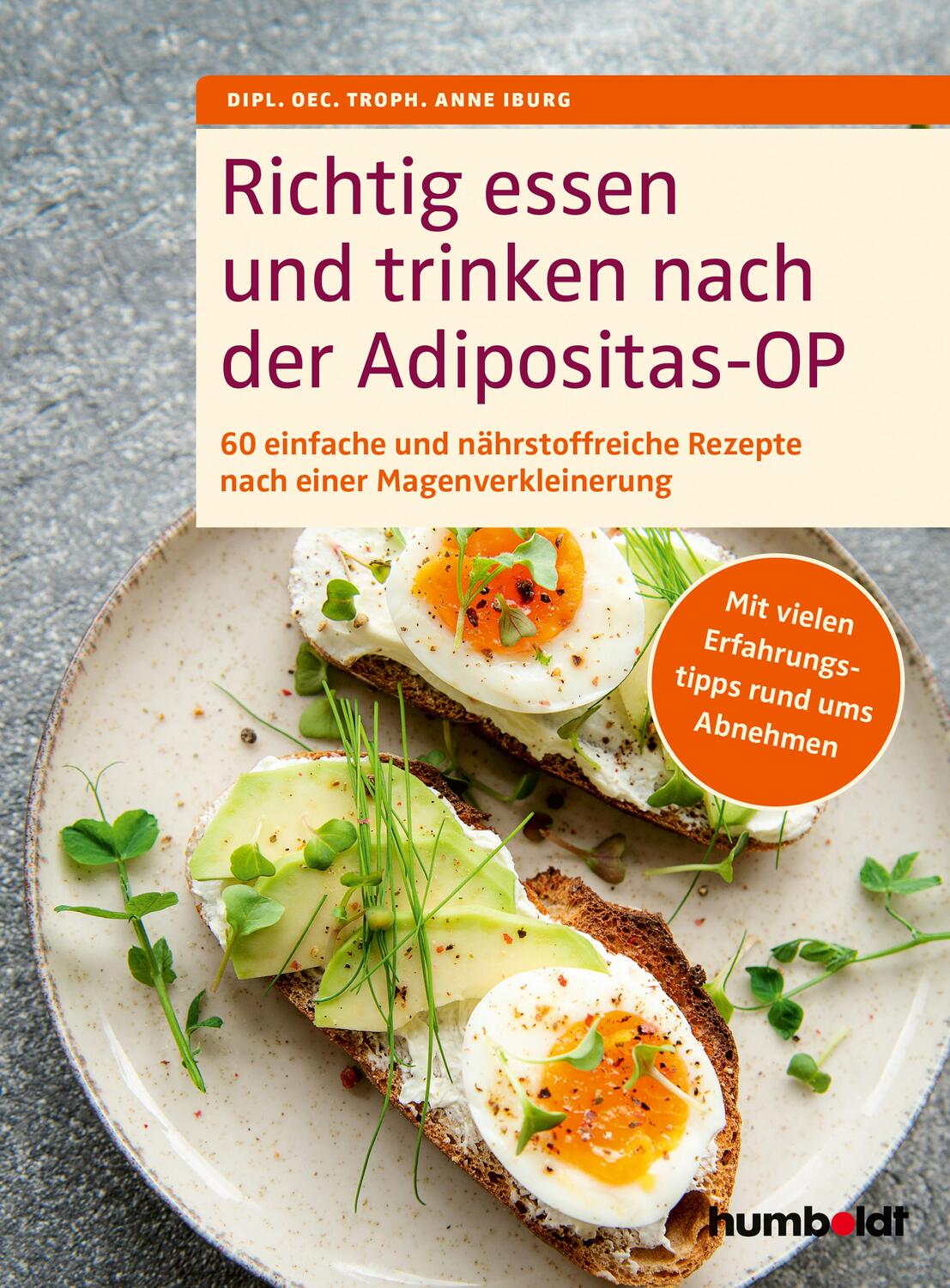 Cover: 9783842631786 | Richtig essen und trinken nach der Adipositas-OP | Iburg | Taschenbuch