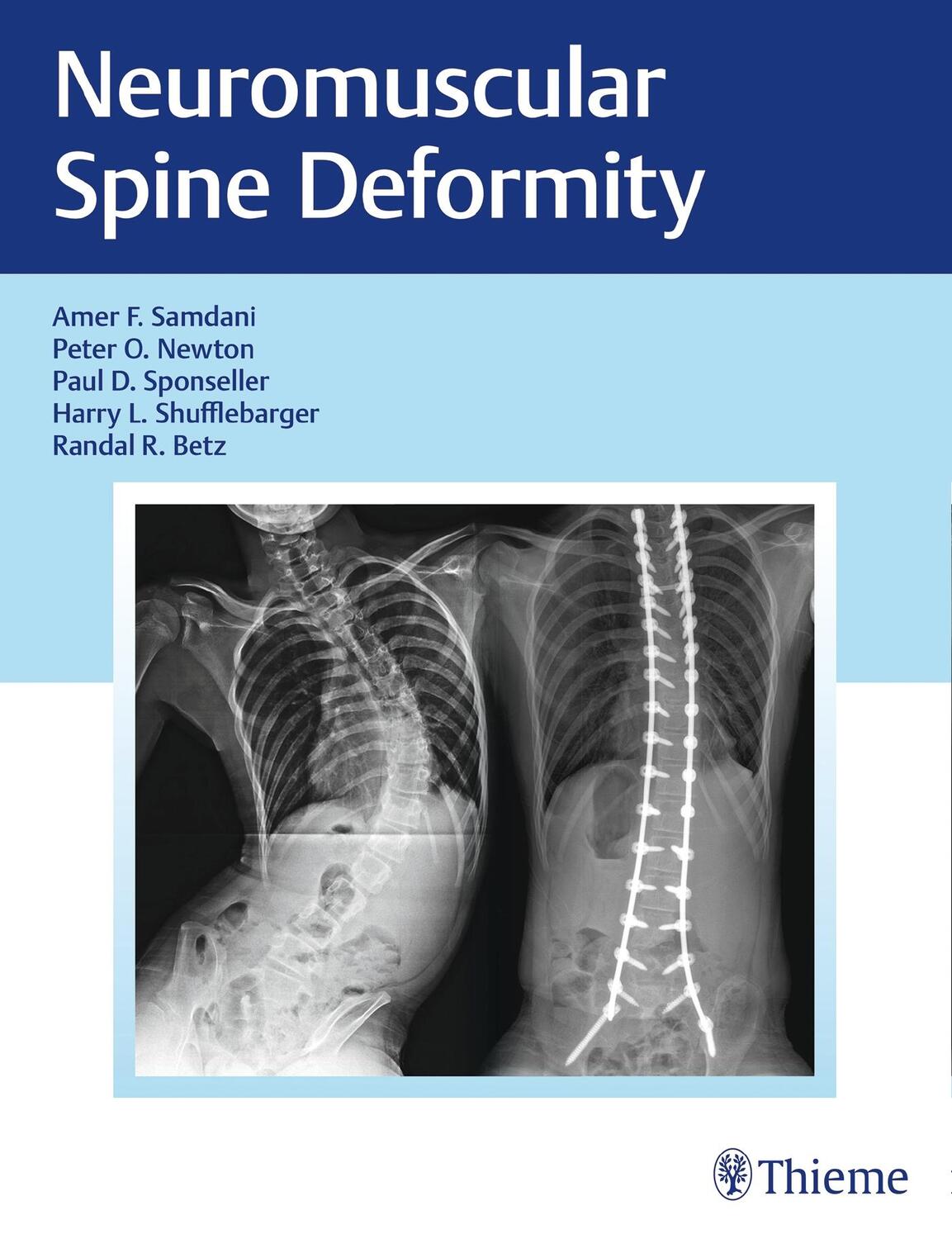 Cover: 9781626232600 | Neuromuscular Spine Deformity | Amer F Samdani (u. a.) | Buch | 206 S.