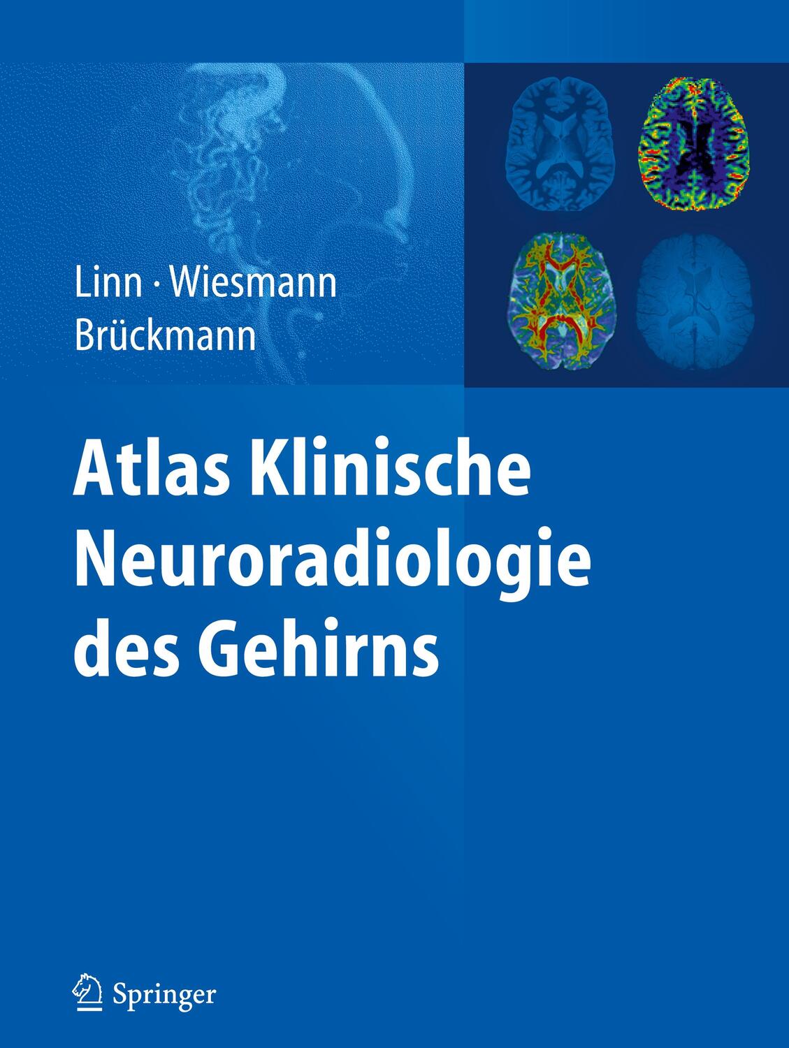 Cover: 9783540895688 | Atlas Klinische Neuroradiologie des Gehirns | Jennifer Linn (u. a.)