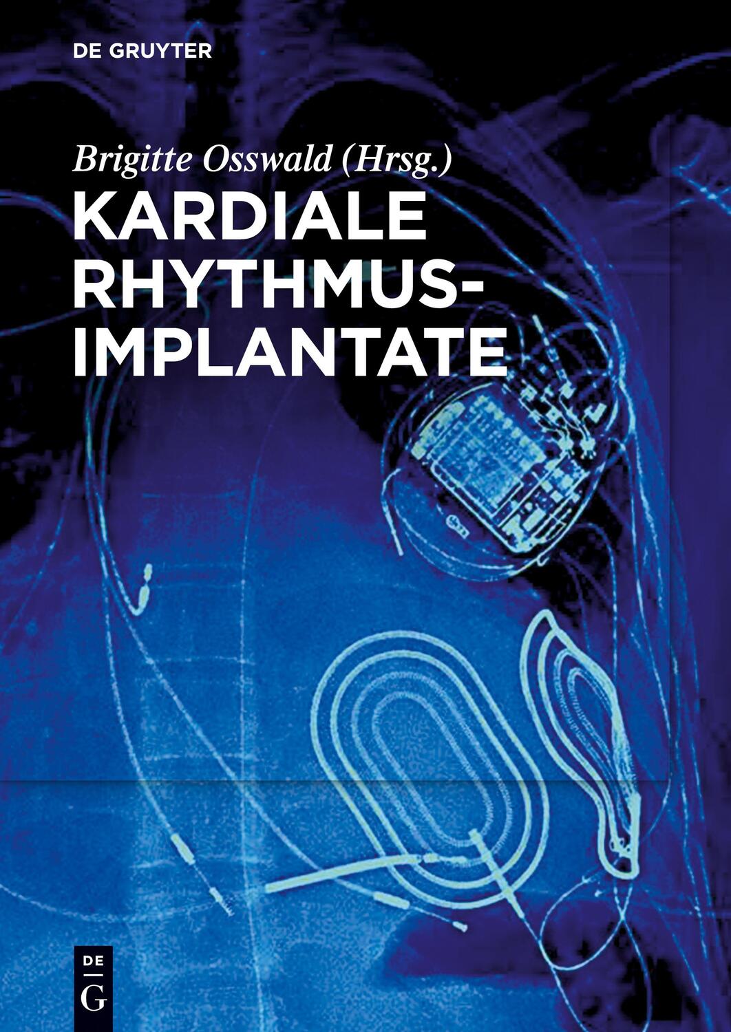 Cover: 9783110440461 | Kardiale Rhythmusimplantate | Brigitte Osswald | Taschenbuch | XX