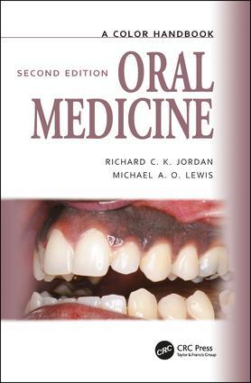 Cover: 9781138494183 | Oral Medicine | Michael Lewis (u. a.) | Taschenbuch | Englisch | 2018