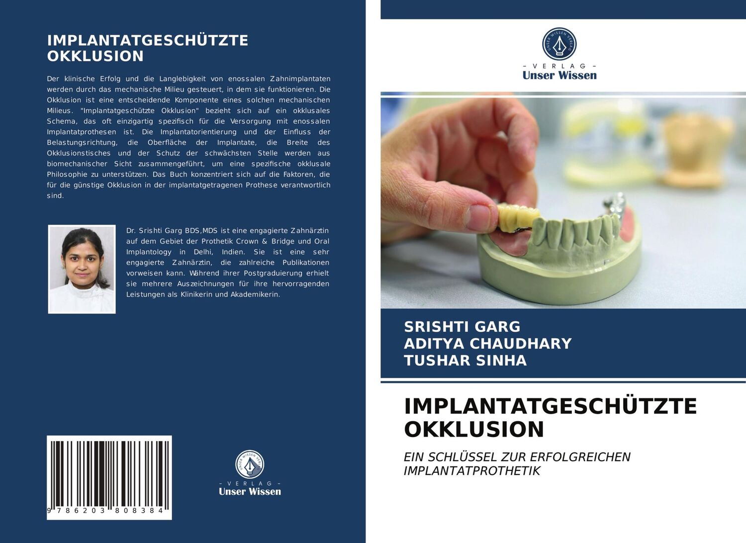 Cover: 9786203808384 | IMPLANTATGESCHÜTZTE OKKLUSION | Srishti Garg (u. a.) | Taschenbuch