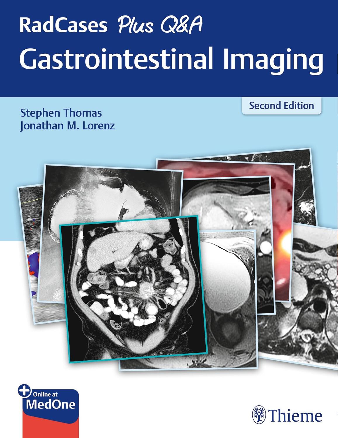 Cover: 9781626238688 | RadCases Plus Q&amp;A Gastrointestinal Imaging | Stephen Thomas (u. a.)
