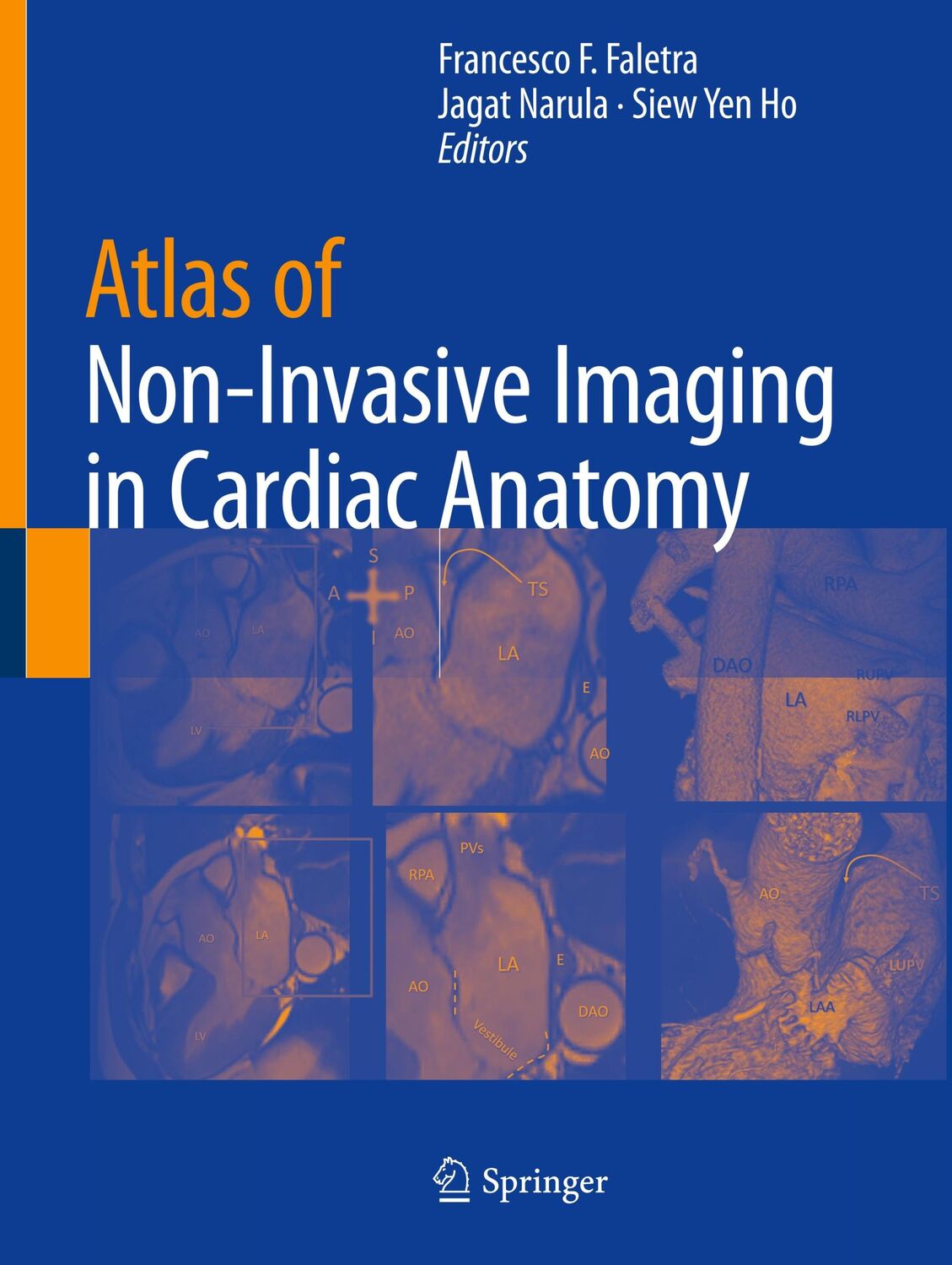 Cover: 9783030355081 | Atlas of Non-Invasive Imaging in Cardiac Anatomy | Faletra (u. a.)