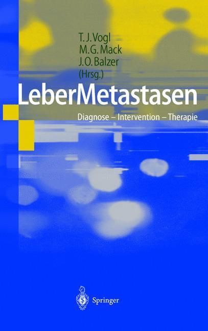 Cover: 9783642639586 | LeberMetastasen | Diagnose ¿ Intervention ¿ Therapie | Vogl (u. a.)