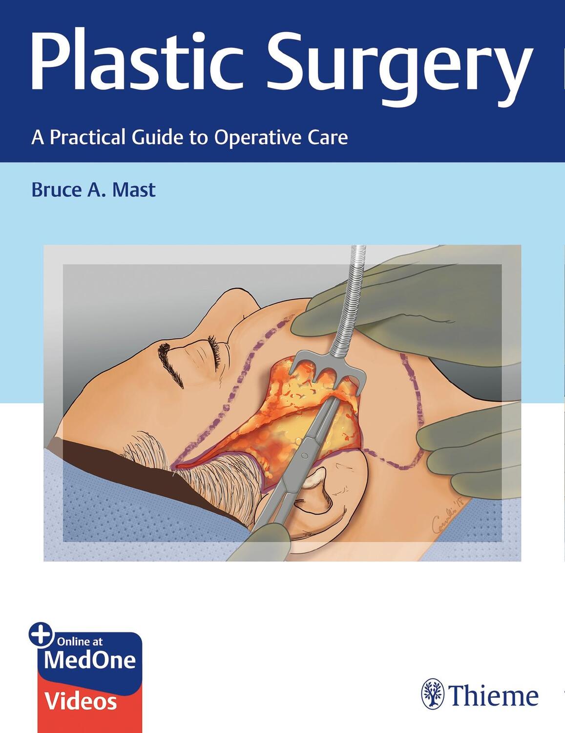 Cover: 9781626232587 | Plastic Surgery: A Practical Guide to Operative Care | Bruce A. Mast