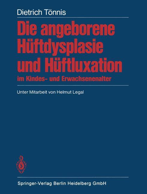 Cover: 9783662066225 | Die angeborene Hüftdysplasie und Hüftluxation im Kindes- und...