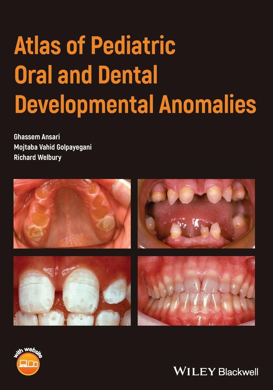 Cover: 9781119380856 | Atlas of Pediatric Oral and Dental Developmental Anomalies | Ansari