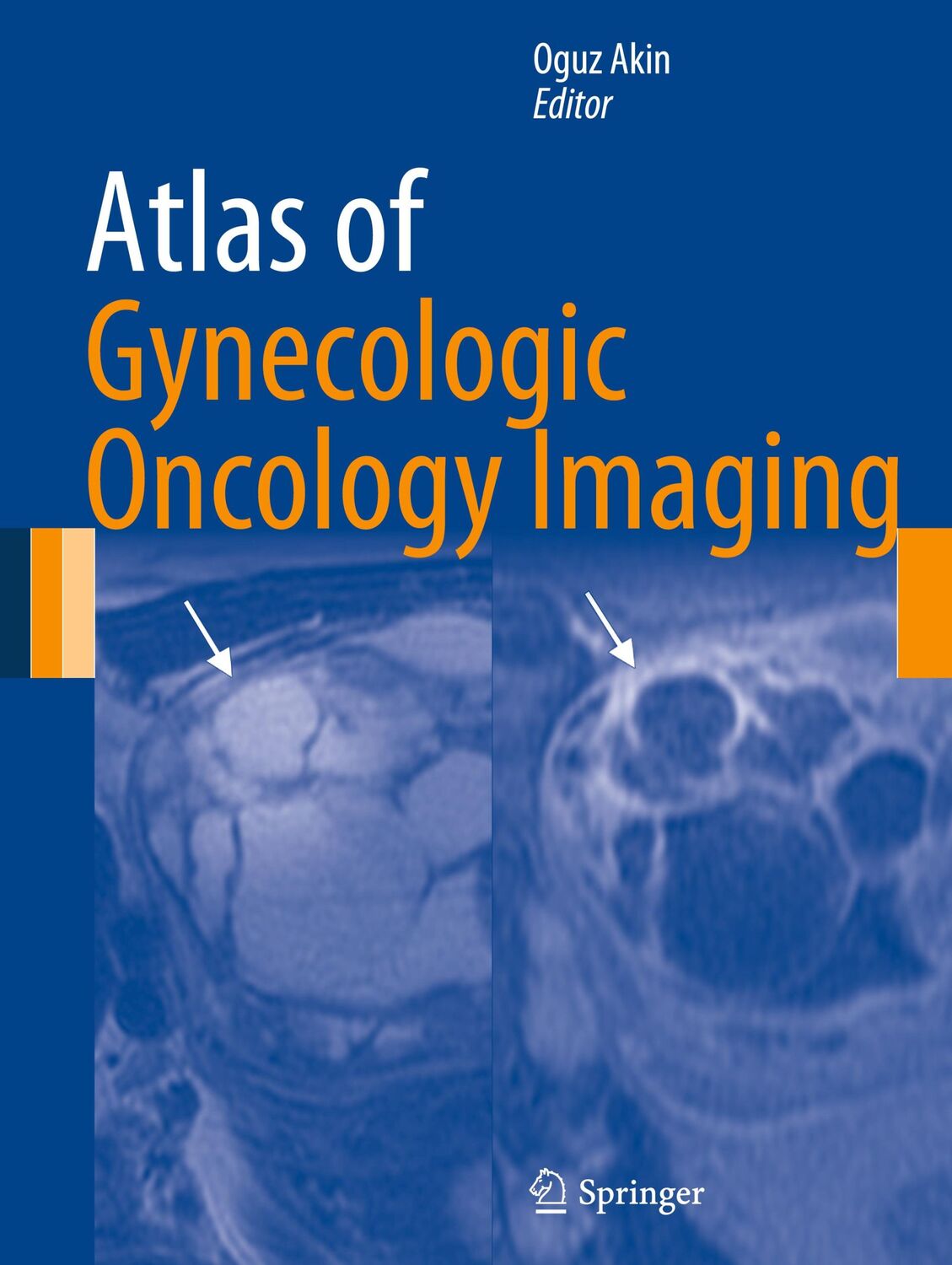 Cover: 9781461472117 | Atlas of Gynecologic Oncology Imaging | Oguz Akin | Buch | ix | 2013