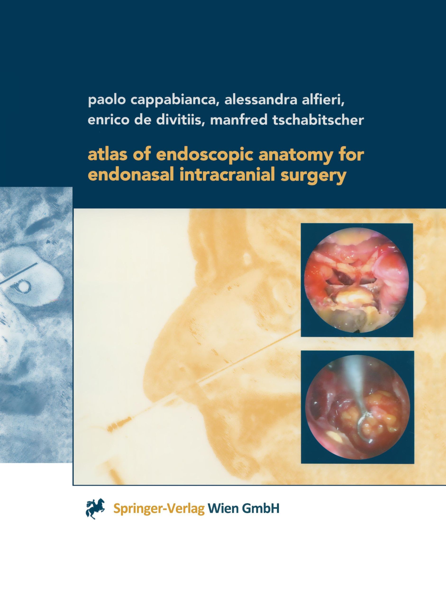 Cover: 9783709172551 | Atlas of Endoscopic Anatomy for Endonasal Intracranial Surgery | Buch