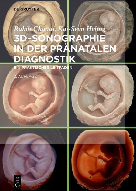 Cover: 9783111251448 | 3D-Sonographie in der pränatalen Diagnostik | Rabih Chaoui (u. a.)