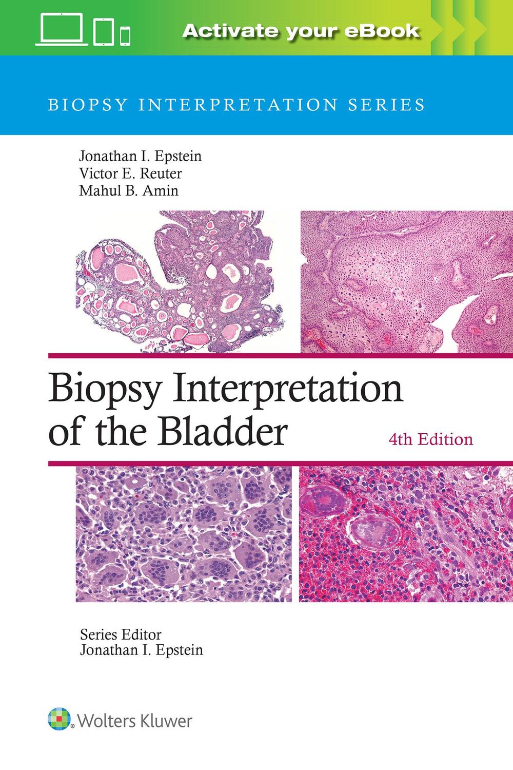 Cover: 9781975199203 | Biopsy Interpretation of the Bladder | Jonathan I. Epstein | Buch