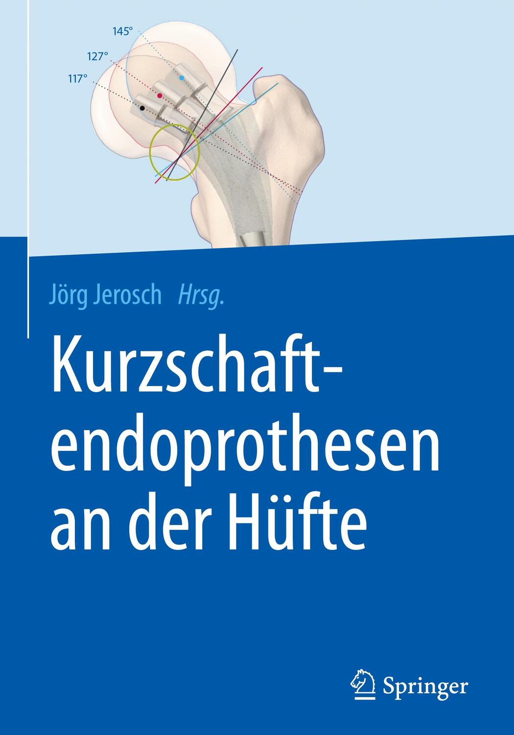 Cover: 9783662527436 | Kurzschaftendoprothesen an der Hüfte | Jörg Jerosch | Buch | Deutsch