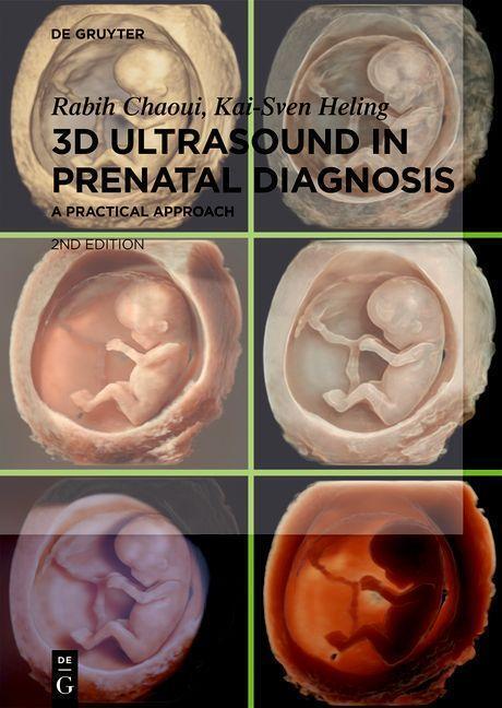 Cover: 9783111249094 | 3D Ultrasound in Prenatal Diagnosis | A Practical Approach | Buch