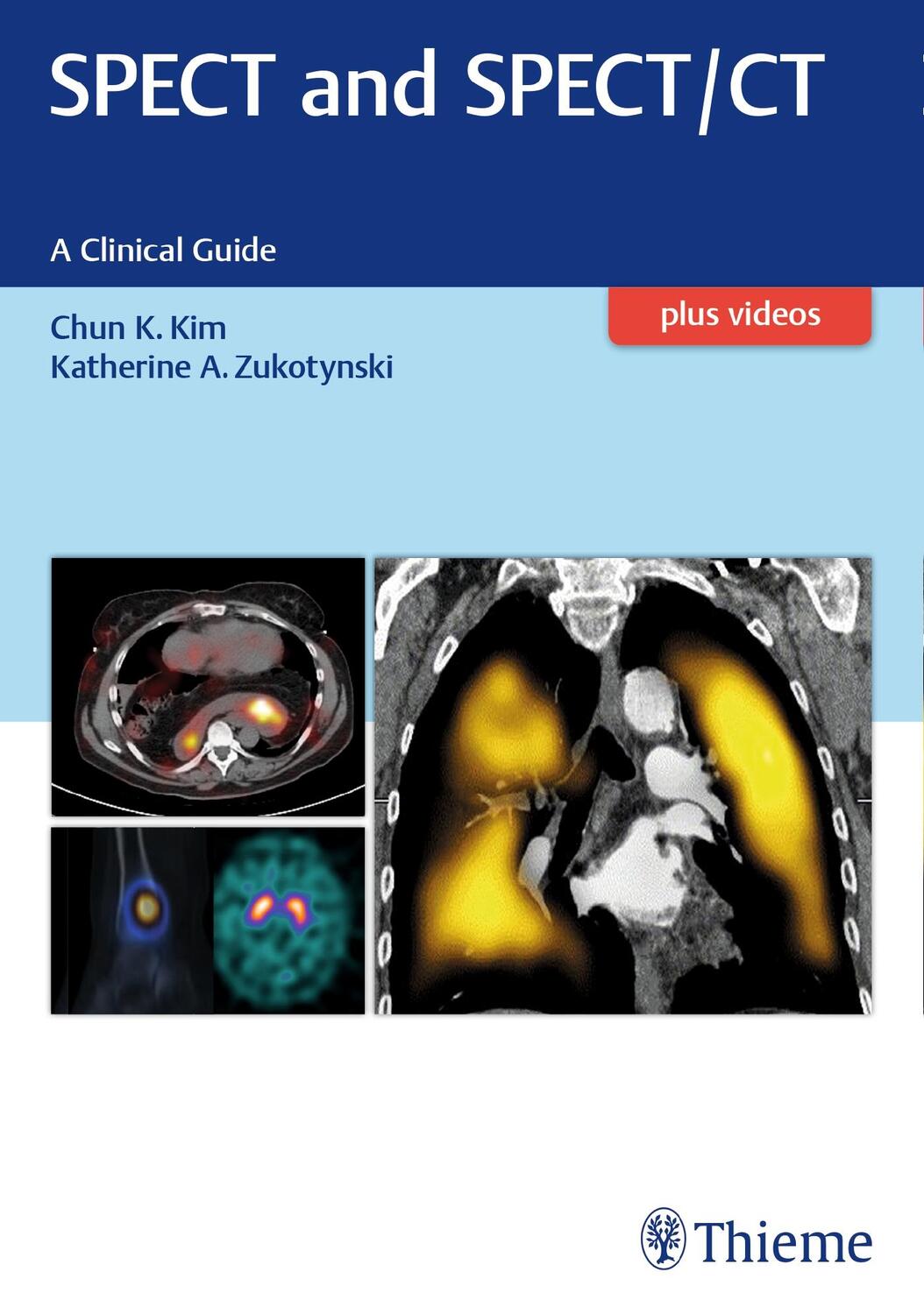 Cover: 9781626231511 | Spect and Spect/CT: A Clinical Guide | Chun Kim (u. a.) | Taschenbuch