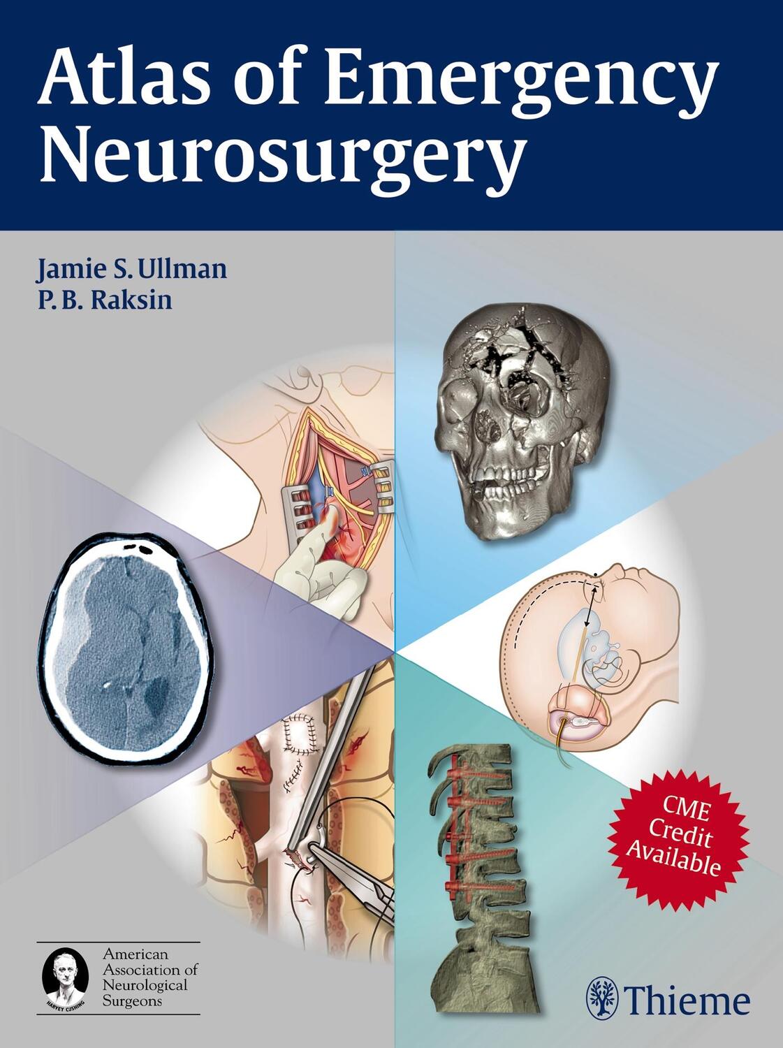 Cover: 9781604063684 | Atlas of Emergency Neurosurgery | Jamie S. Ullman (u. a.) | Buch